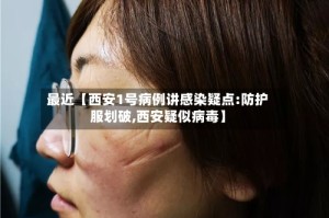 最近【西安1号病例讲感染疑点:防护服划破,西安疑似病毒】