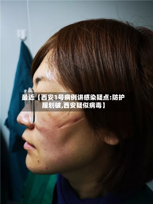 最近【西安1号病例讲感染疑点:防护服划破,西安疑似病毒】-第1张图片