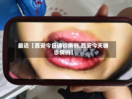 最近【西安今日确诊病例,西安今天确诊病例】-第2张图片