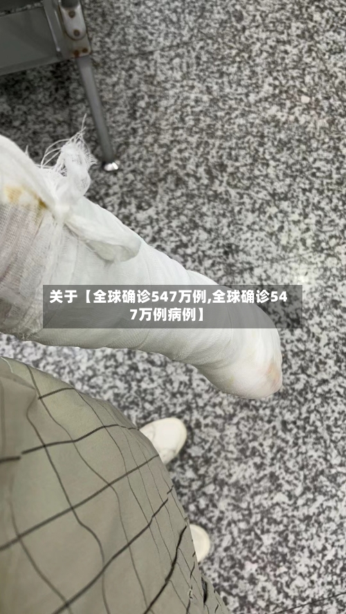 关于【全球确诊547万例,全球确诊547万例病例】-第1张图片