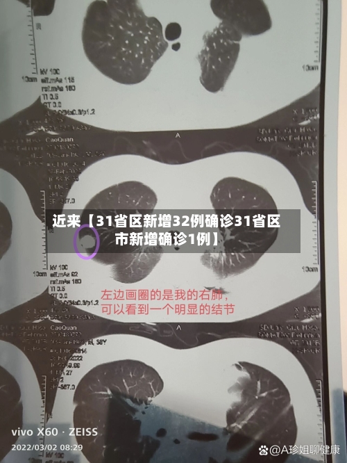 近来【31省区新增32例确诊31省区市新增确诊1例】-第1张图片