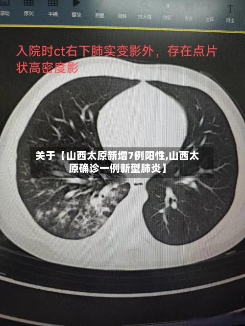 关于【山西太原新增7例阳性,山西太原确诊一例新型肺炎】-第2张图片