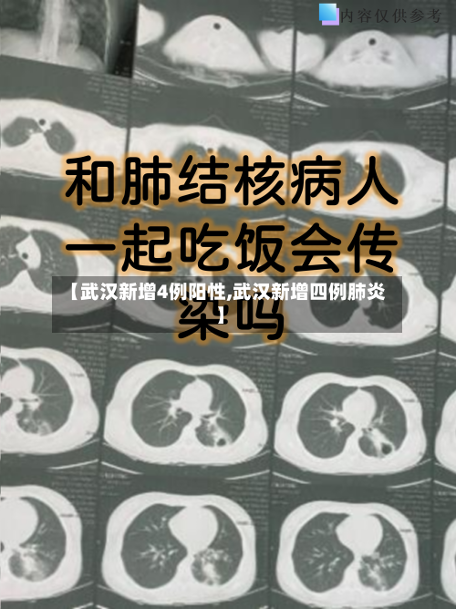 【武汉新增4例阳性,武汉新增四例肺炎】-第1张图片