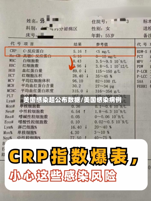 美国感染超公布数据/美国感染病例-第1张图片