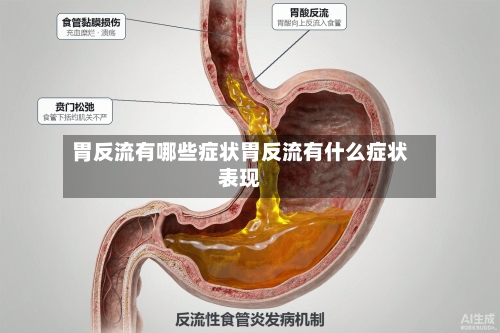 胃反流有哪些症状胃反流有什么症状表现