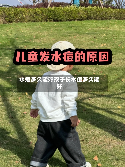 水痘多久能好孩子长水痘多久能好