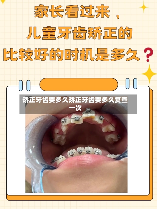 矫正牙齿要多久矫正牙齿要多久复查一次