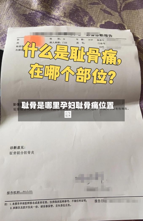 耻骨是哪里孕妇耻骨痛位置图